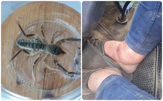 SARI KIZ Ã–RÃœMCEÄžÄ° HASTANELÄ°K ETTÄ°