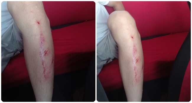 GENÃ‡ SPORCUYA KÃ–PEKLER SALDIRDI