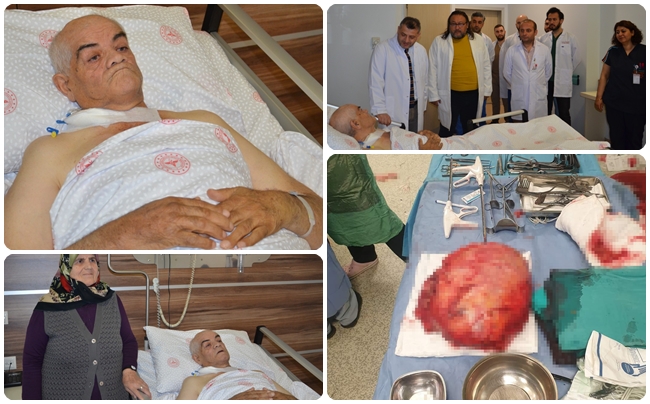 AYAKLARI AÄžRIDIÄžI Ä°Ã‡Ä°N HASTANEYE GÄ°TTÄ° UYLUK KEMÄ°ÄžÄ°NDEN 8,9 KÄ°LO TÃœMÃ–R Ã‡IKTI